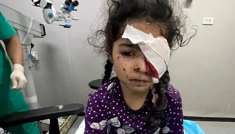 مركز غزة: 1700 فلسطيني فقدوا أعينهم و 5 آلاف آخرين مهددون بفقد نظرهم جراء العداون الإسرائيلي