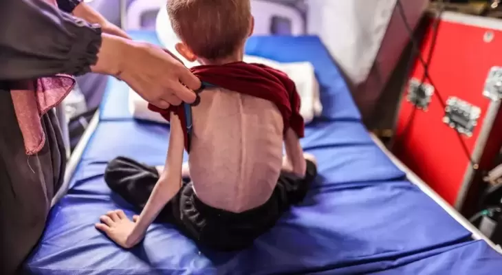  الصحة بغزة:ارتفاع عدد حالات الوفاة نتيجة المجاعة الى 453 حالة
