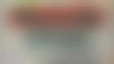 غداً.. تدشين مخيم مجاني للعيون لأسر الشهداء في بني حشيش بمحافظة صنعاء