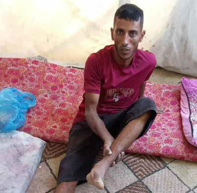 شظية غيرت مصيره.. محمد الراس يبحث عن طرف يعيده لأسرته