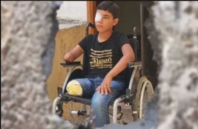 البرش يدعو لمقاطعة "أديداس" بسبب ترويجها لحذاء عبر جندي صهيوني وفي غزة 8 آلاف مبتور