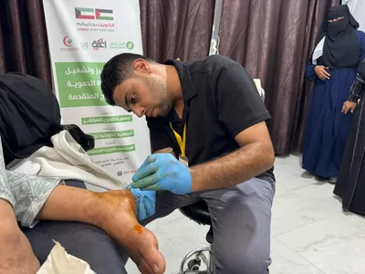 غزة: معاناة مضاعفة لمرضى الأوعية الدموية والقدم السكرية في ظل النزوح ونقص الخدمات