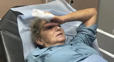 الأمم المتحدة تدعو للتحقيق في اعتداء مستوطنين على مصورة أمريكية في الضفة